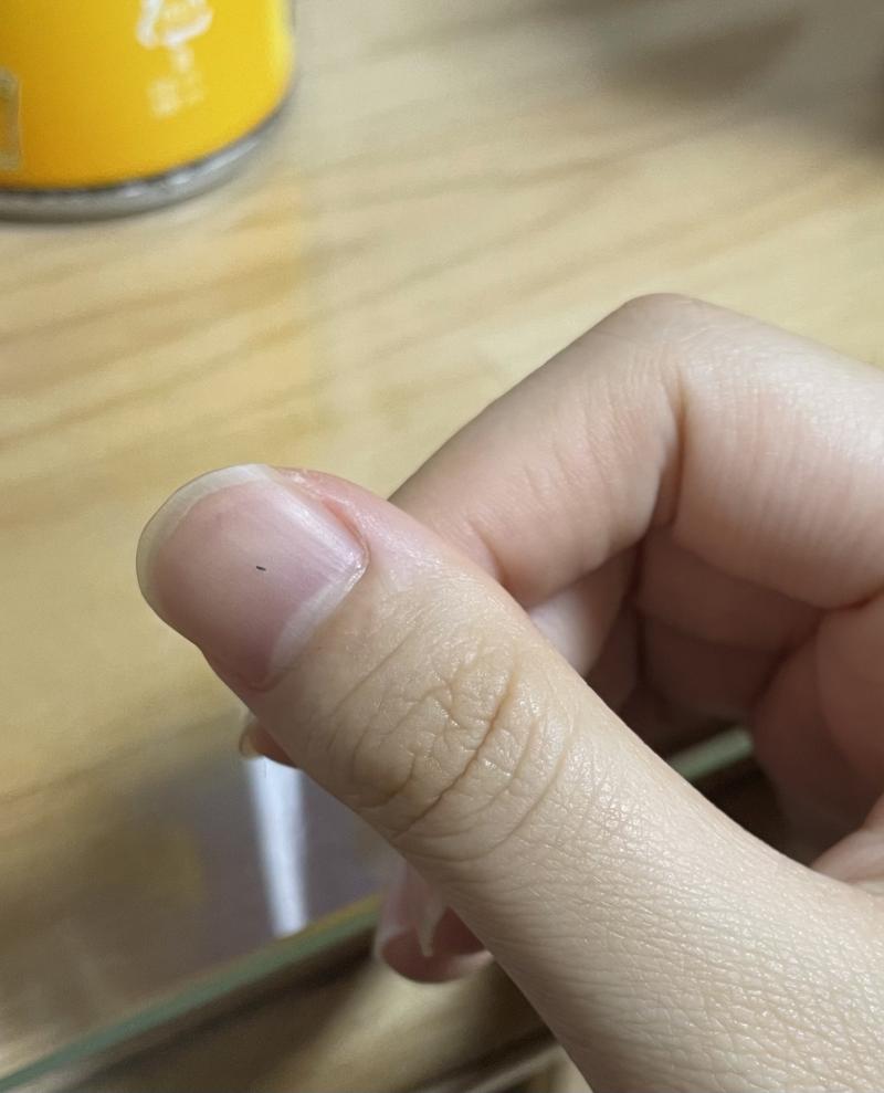 ㅅㅂ 이거 벌레임 얘들아 ㅅㅂ 나 벌레랑 살아야 되는거? 코긁다가 발견했는데 ㅅㅂ뒤지겠네 썅