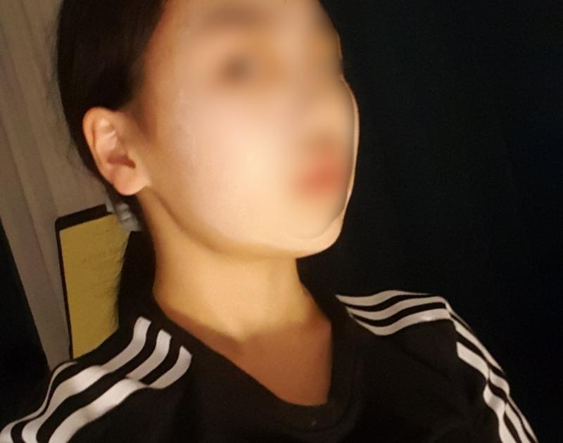 순서대로 왼쪽 오른쪽