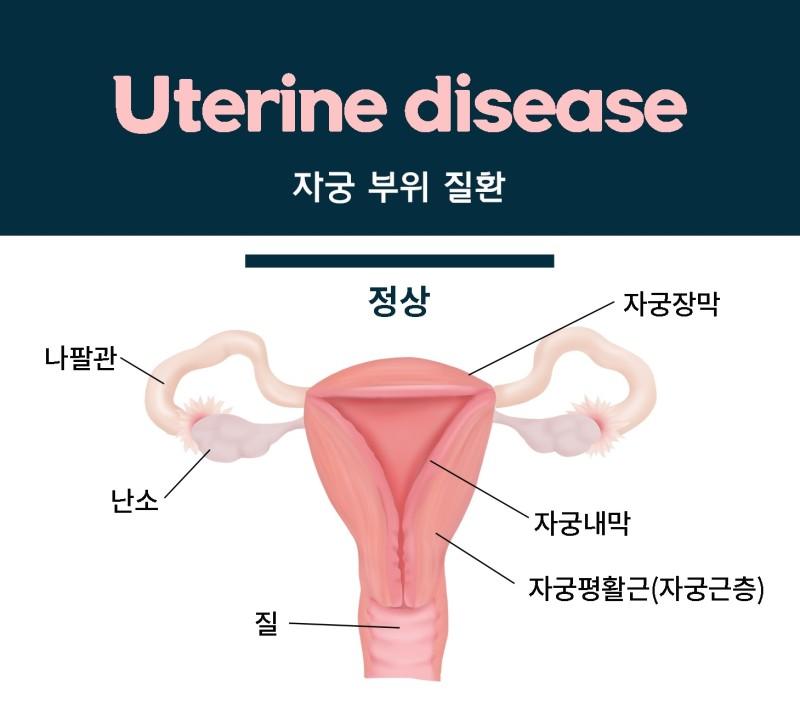 >>29 아마 손으로 하는것 같은데 둔탁하게 닿인다고 하는 부분이 아마 자궁경부입구 부분일거야 자궁경부는 질처럼 다른걸 밀어넣는다고해서 늘어나지