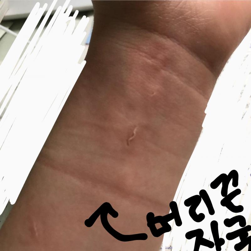 이것도 혹시나 사진들 트리거 눌릴 수 있겠다 싶으면 열어보지마 그냥 언니가 손톱으로 낸 상처긴한데 혹시나 해서
