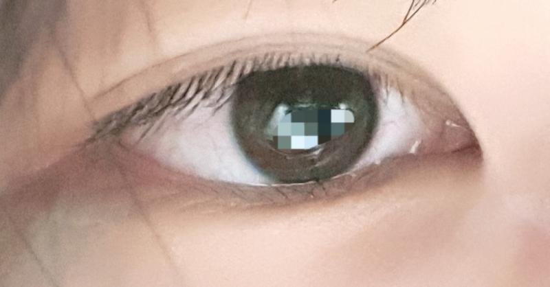 나 레준디 이런 눈도 괜찮ㄴ지? 쌍수 이렇게 하면 괜찮겟ㅅㄴ지??