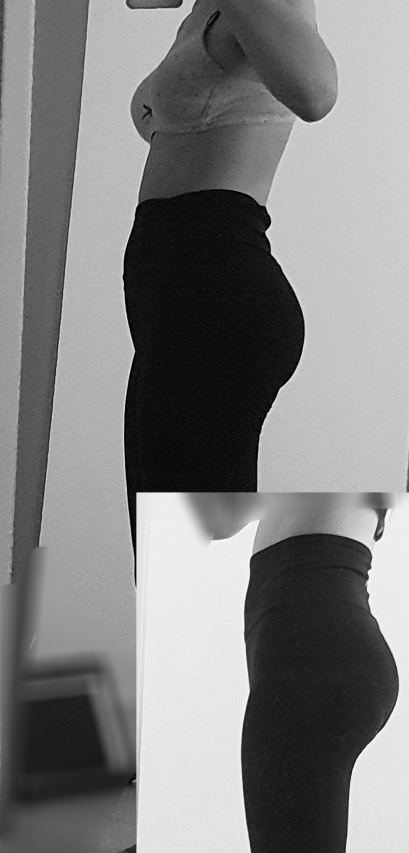 7월 21일 그리고 7월 30일. 허벅지가 조곰 떨어졌고 배가 좀 많이 들어감! 골반이 짝짝인 건지 틀어진 건지 다른 운동도 병행을 해야할 거 