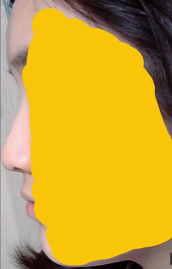 코 높이 어떤 편이야?