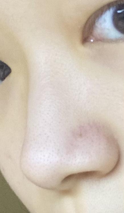 코 피부는 무시해줘…ㅠ