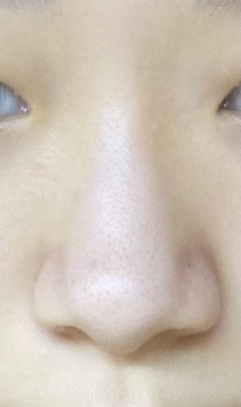 코 피부는 무시해줘…ㅠ