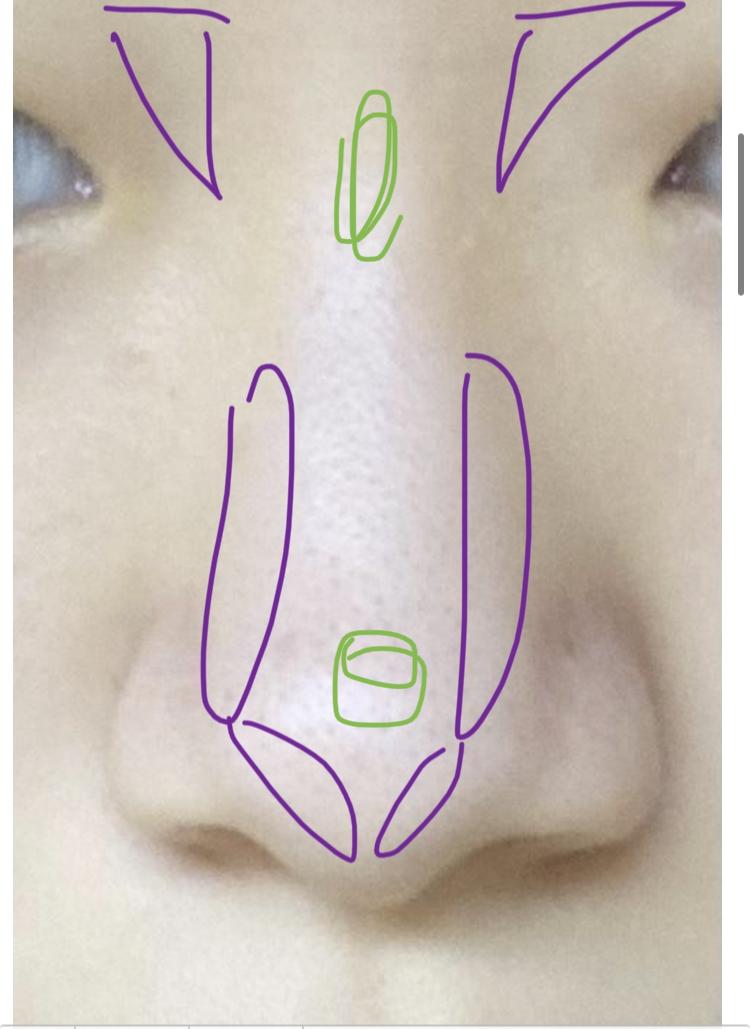 보라색은 쉐딩이고 초록색은 하이라이터야!! 레주 코 보면 위쪽은 콧대가 얇은데 아래쪽으로 내려오면서 콧대가 두꺼워지는 코인 것 같아 그래서 위쪽