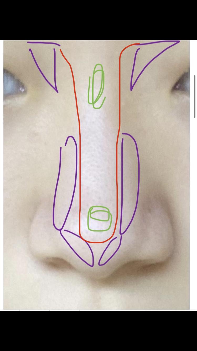 보라색은 쉐딩이고 초록색은 하이라이터야!! 레주 코 보면 위쪽은 콧대가 얇은데 아래쪽으로 내려오면서 콧대가 두꺼워지는 코인 것 같아 그래서 위쪽