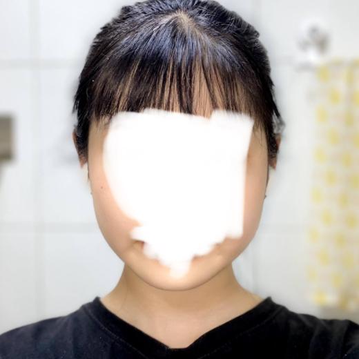 1본 사진 운동 전 무표정 2번 사진 운동 전 웃음 3번 사진 운동 후 방금 찍은 무표정 세 사진 다 정면임 ㄹㅇ 다들 운동해