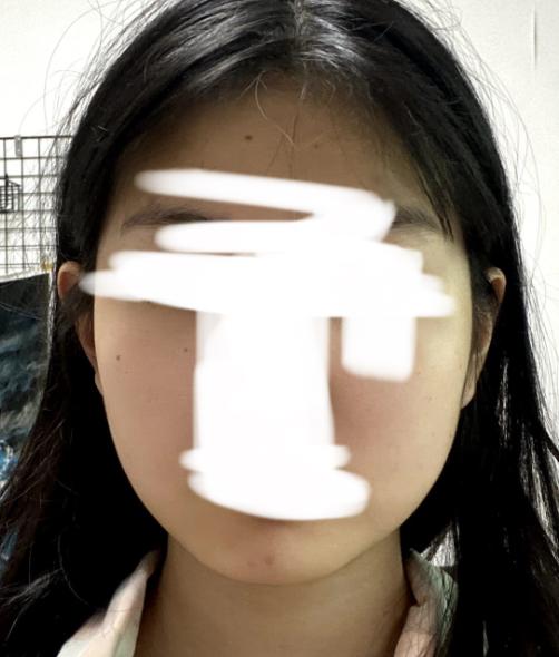 1본 사진 운동 전 무표정 2번 사진 운동 전 웃음 3번 사진 운동 후 방금 찍은 무표정 세 사진 다 정면임 ㄹㅇ 다들 운동해