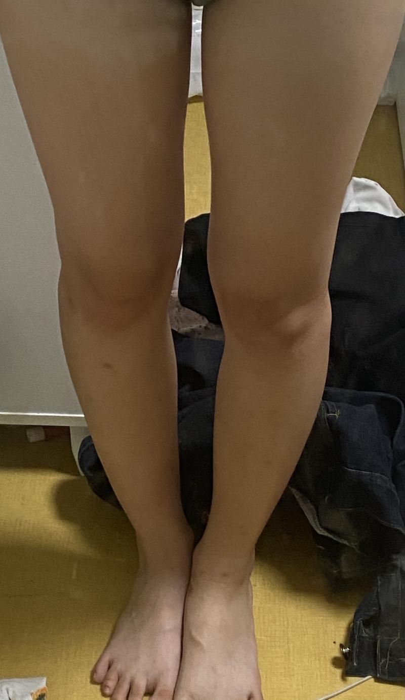 운동 후 내 다리 오다리 교정 운동도 일주일에 3,4번 하는 즁이야 1번 사진 어제 2번 사진 방금