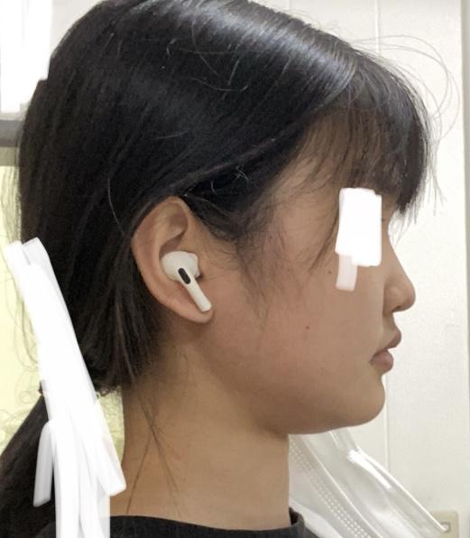 코도 좀 높아진건 내 기분탓? 운동 한 번도 안햤을 때 사진이랑 2분 전에 찍은 사진 비교샷 올릴테니까 한 번만 봐주랔ㅋㅋ