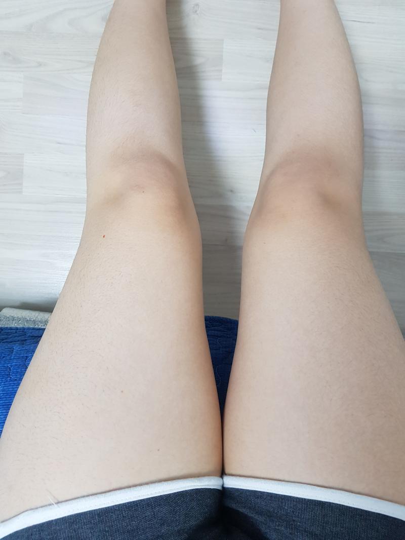 내 다리를 보면 좀 안심될거야 다들...존나무슨 무 두개 의족으로 삼고있는거같음