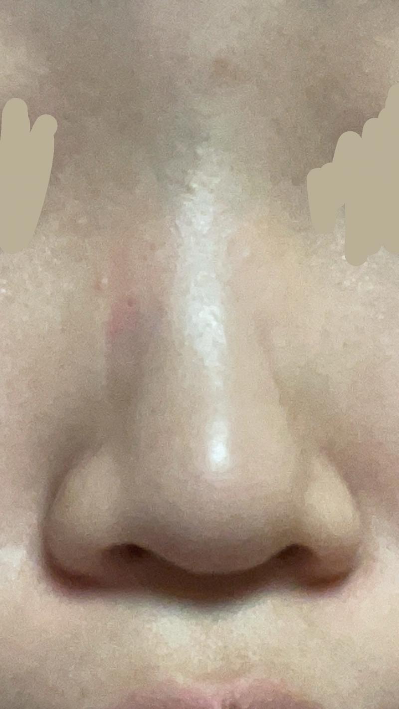 이건 내 코!
