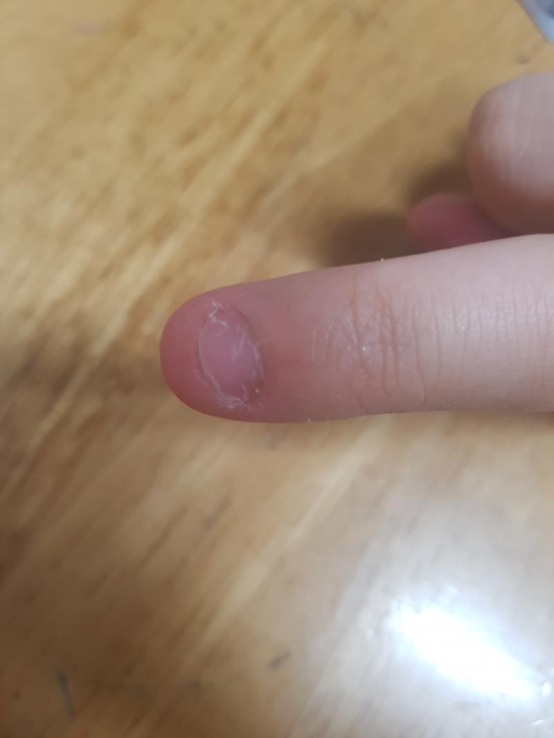 보기싫은 사람은 안보는거 추천..