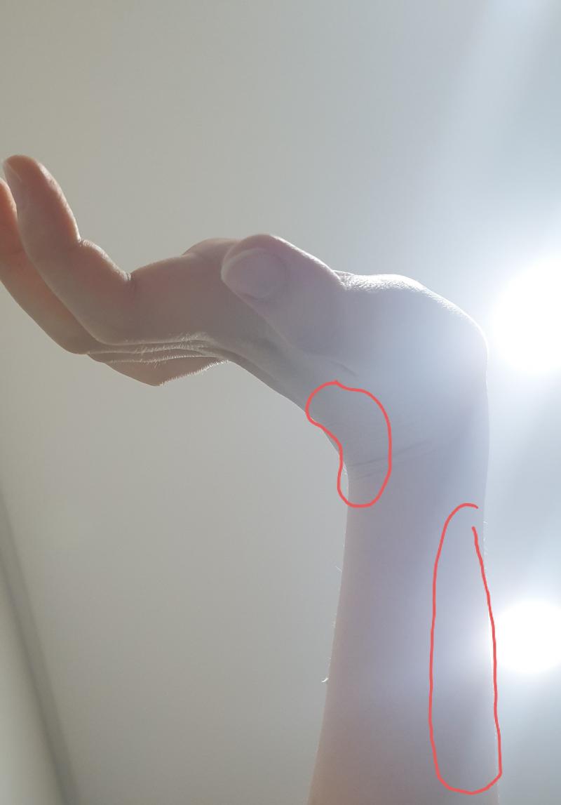 >>19 해보려고 했는데 손가락이 안펴짐;;;; 뭐가 근육이 당기는걸?