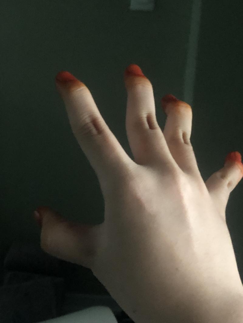 안되는데 이건 됨