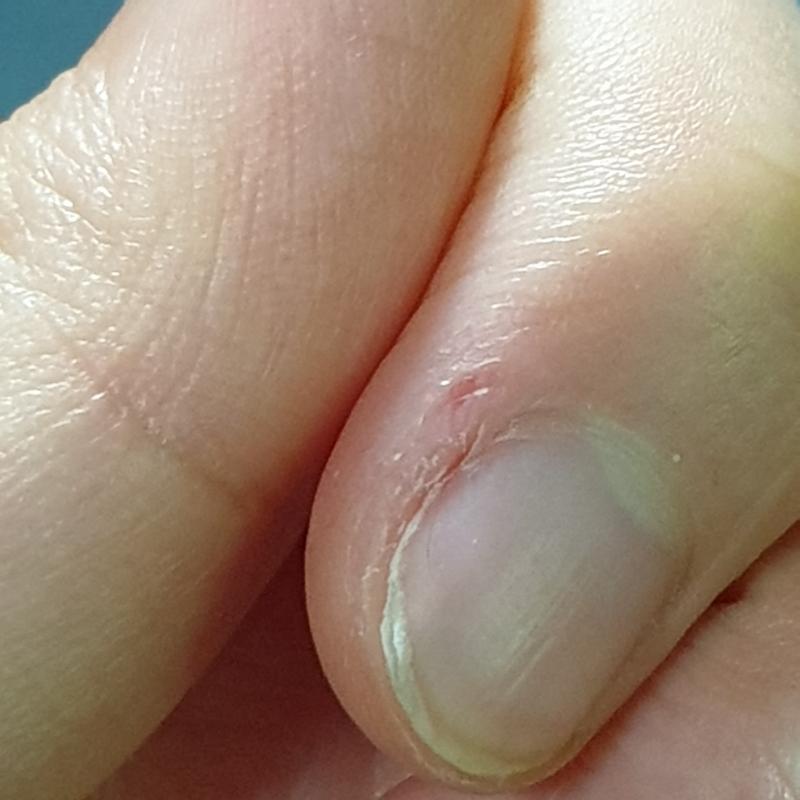 너는 좀 심각하다... 나는 그냥 이 정도인데... 핸드크림 자주 발라서 손을 촉촉하게 유지하면 좀 들 뜯게 되더라 그리고 그 뾰족한 손톱깎이 