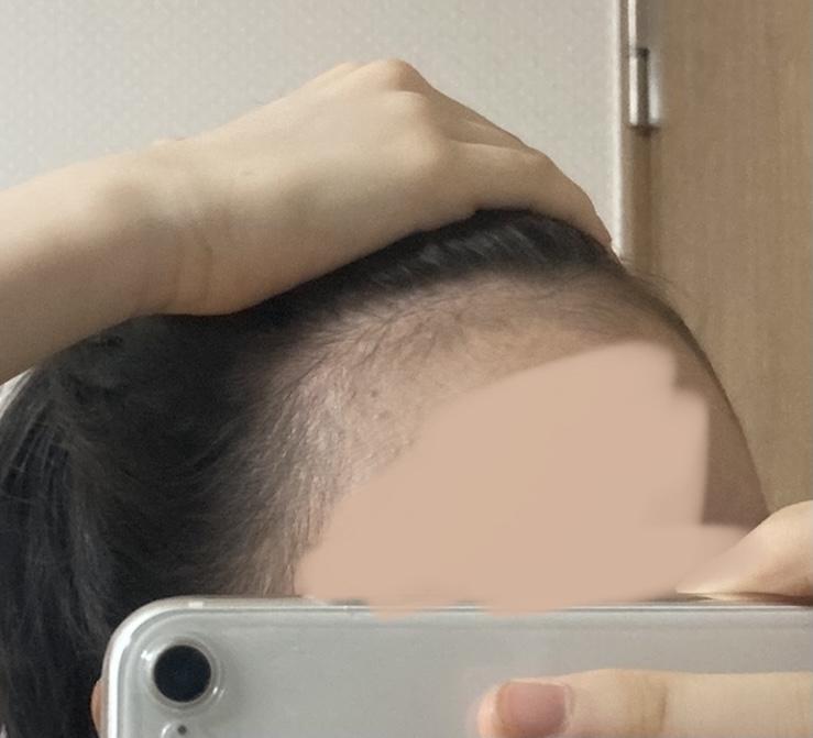 사진…