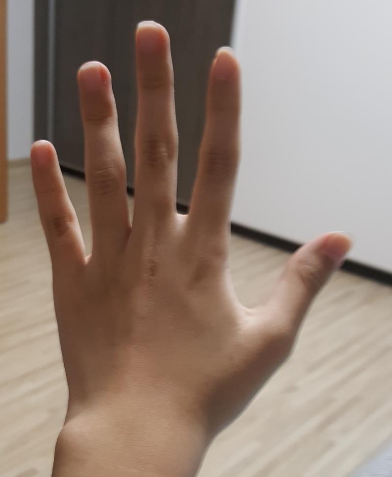 2일차 그냥 평소랑 똑같다! 근데 안바르던 핸드크림을 수시로 바르니 조금만 건조해도 땡김 그래서 계속 핸드크림만 발라대다가 부모님한테 혼났다..