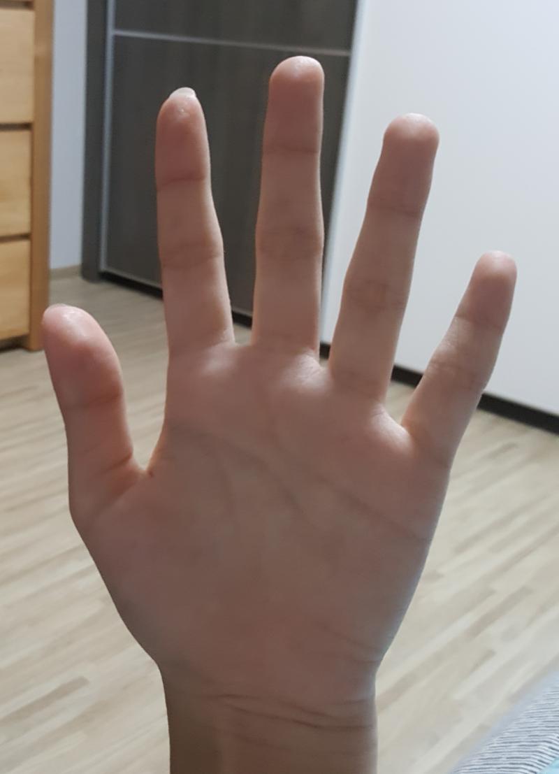 2일차 그냥 평소랑 똑같다! 근데 안바르던 핸드크림을 수시로 바르니 조금만 건조해도 땡김 그래서 계속 핸드크림만 발라대다가 부모님한테 혼났다..