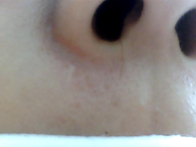 조기 일자로 죽 그어진거 상처임 코털 아님>>2