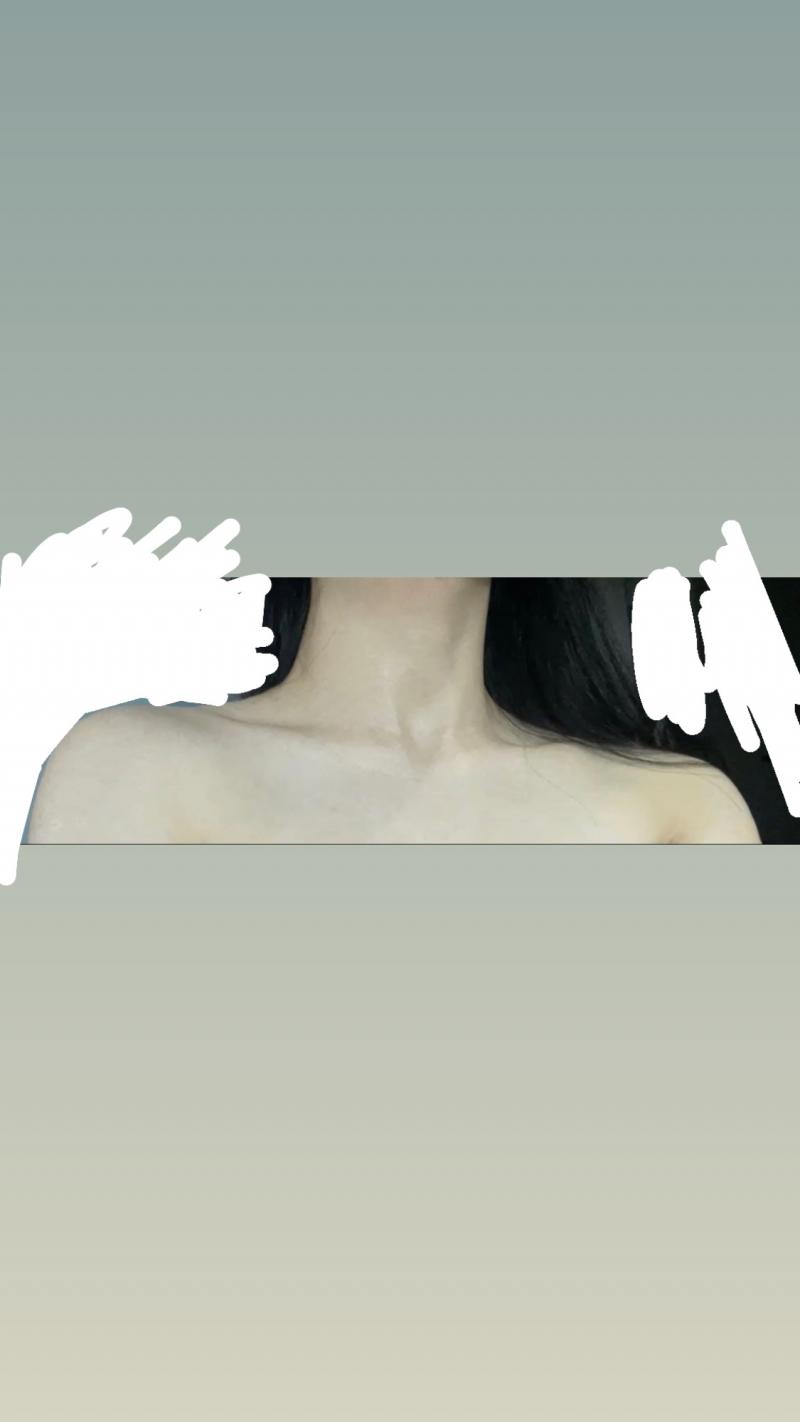 남들보면 선명하게 쇄고ㄹ이 어깨라인까지 이어져있던데 나만 안그런거 같아서 존나 억울함 사람보면 쇄골부터 보여