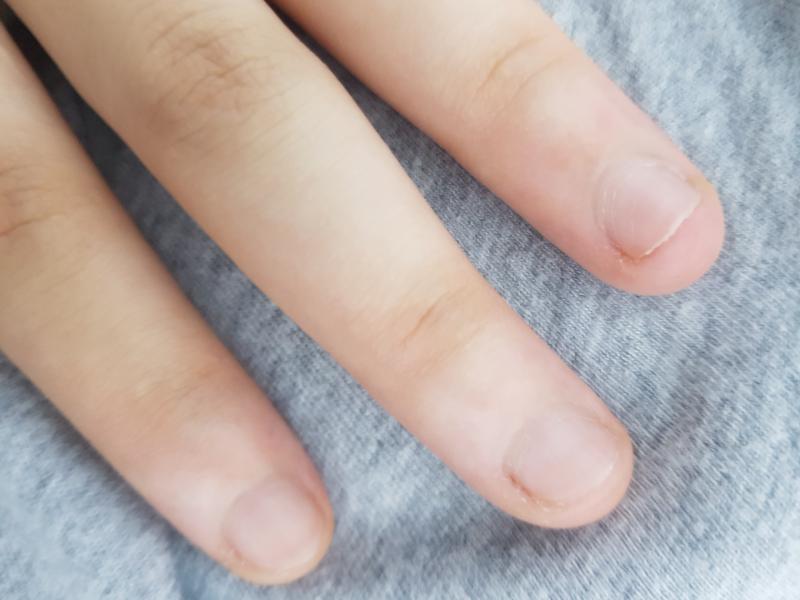 나 바디 개짧음ㅅㅂ 물어뜯는 습관을 못 고쳤어 잼민이 손 같아..
