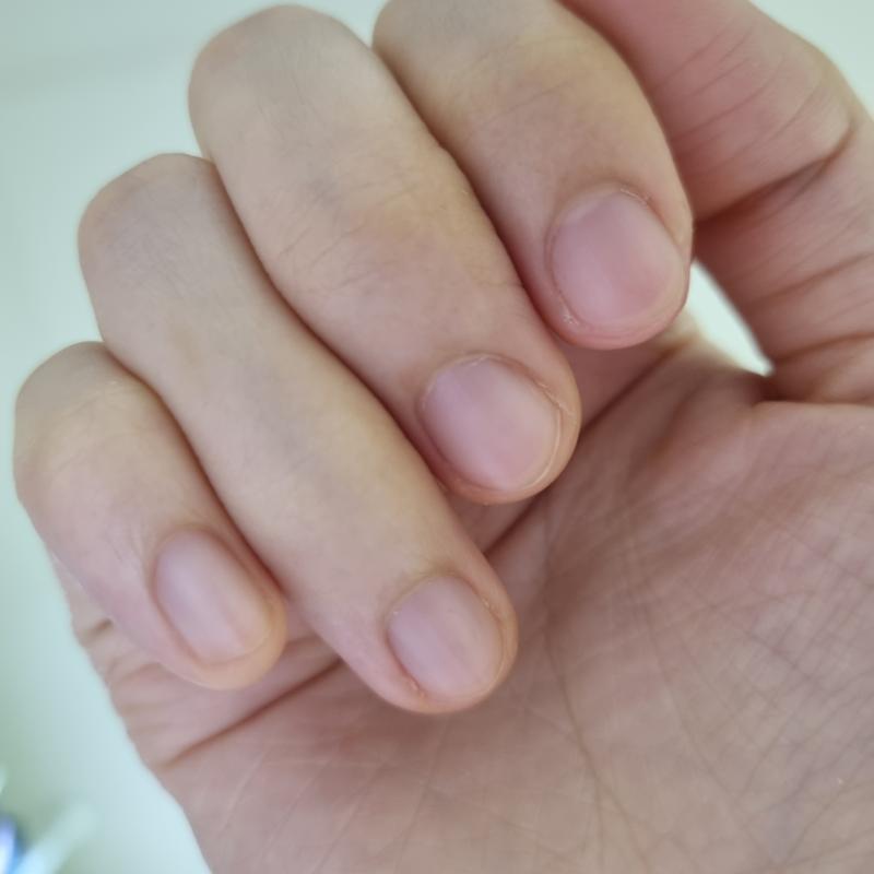 어우 옆에 살왜케 거뭇거뭇해 저거 어떻게 관리해 한번보이니까 되게신경쓰인다