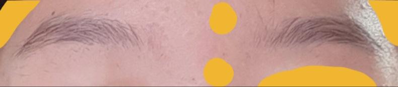 ㅎ