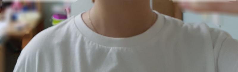 승모근 심한 것처럼 보여?
