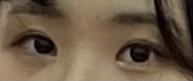 후