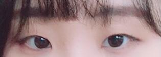 전