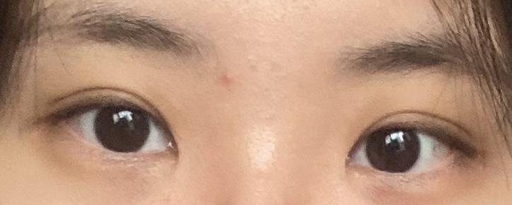 후