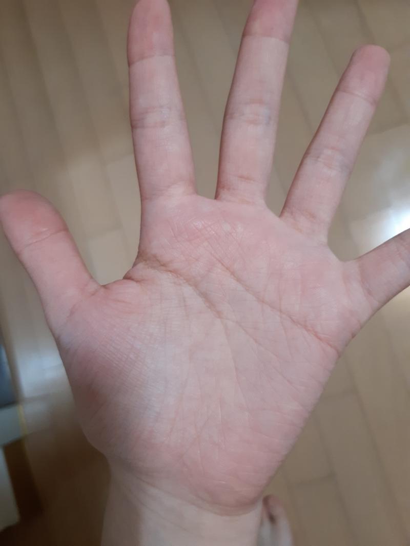 이건 내 손이야 어때 잔주름 그렇게 많아? 나보다 자글자글한사람 못봤어