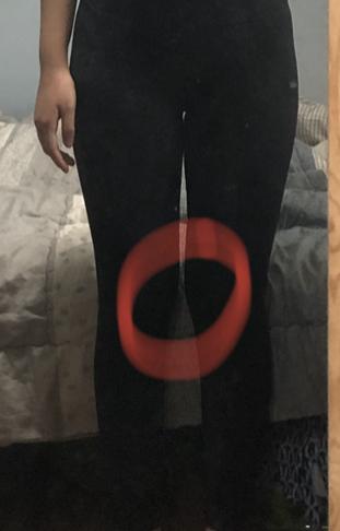 일단 아랫배랑 허벅지랑 엉덩이! 제일 고민인 부분이야 그리고 무릎 사이? 이부분은 그냥 살빼면 일자로 돌아와? 이부분이 튀어나와있는게 너무 거슬