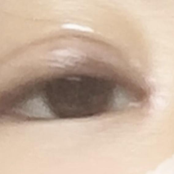 >>4 쌍커풀 두께가 고민이라면 쌍수나 눈매교정을 해야해 ㅠㅠ 앞트임은 몽고주름을 째고 앞으로 당겨 고정하는 수술이야. 화질이 구려서 도움이 될