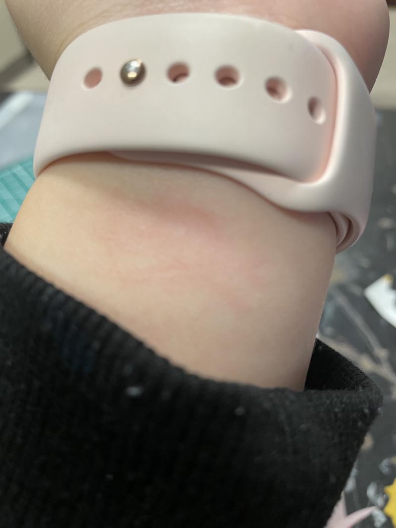 요런 사진 올려도되는진모르겠는데... 일단 첫번째가 막 블루베이비하구 난뒤에 발견한거고 두번째는 지금 일어나서보니까 옅어졌길래 찍어봣어...!