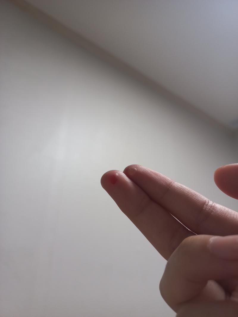 물집 주의⚠️ 가야금 오랜만에 잡았더니 물집이 생겼어ㅠㅜ