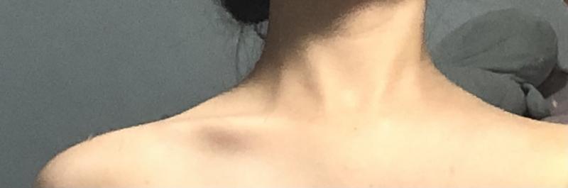 참고로 고1 여자 왼쪽은 있는데 오른쪽은 힘줘야 생겨 이건 대체 어떻게 해야 해...?
