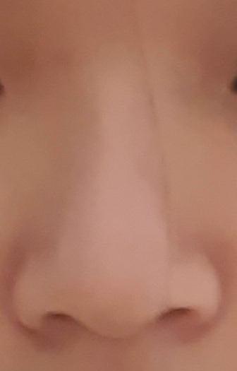 콧구멍만 덜 보이면 좀 나을까?