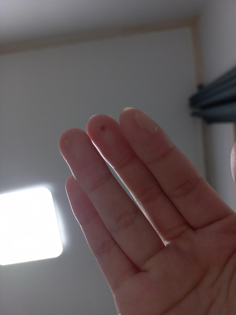 힝구 징그러움 조심