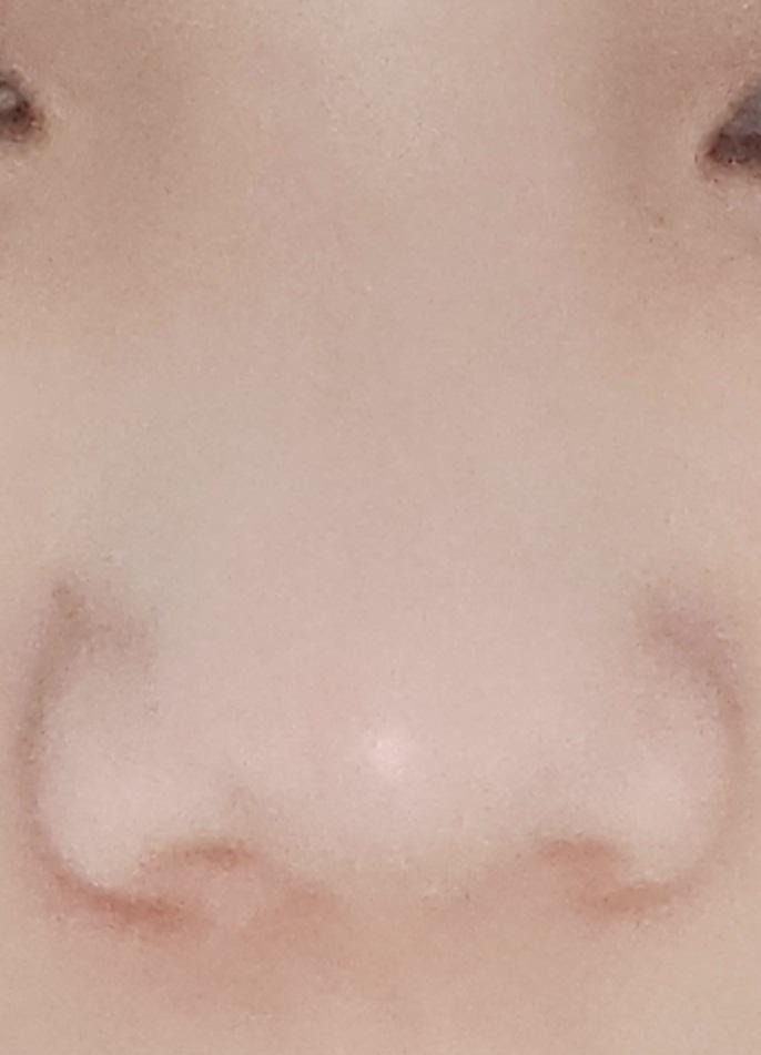 나 고딩되면진짜 바로 코수술ㅇ하고싶다 레더들은 코예뻐서 부럽다