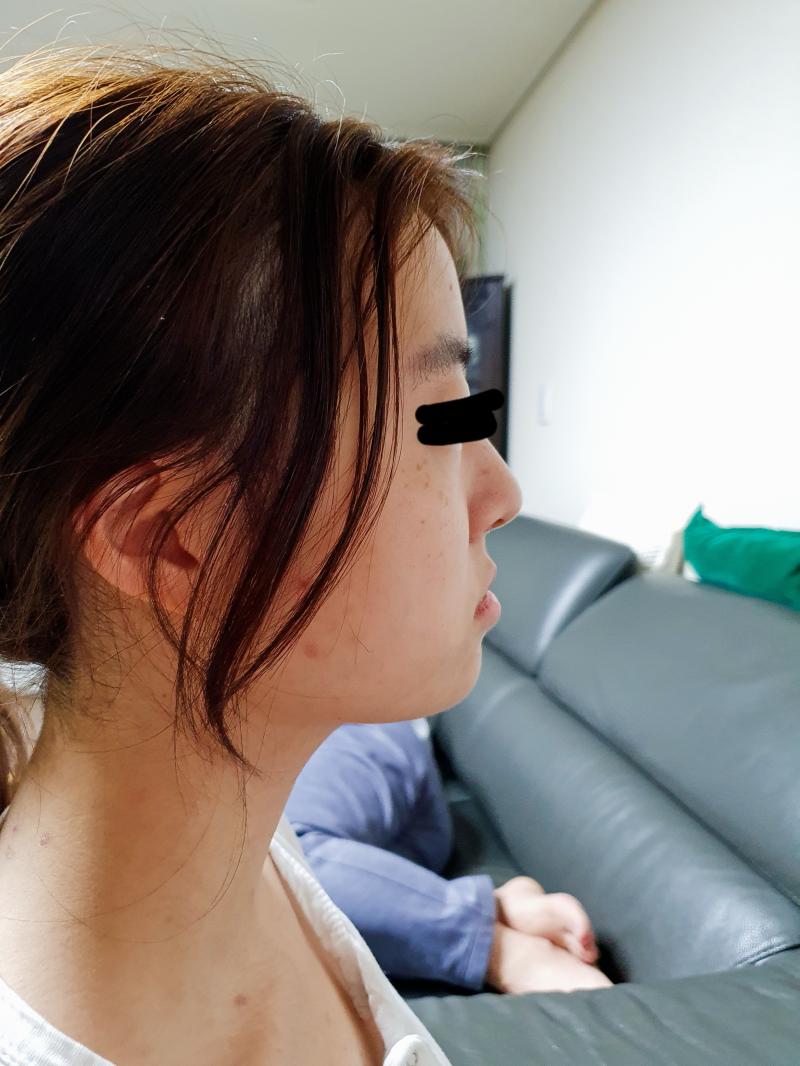>>2 피부 안좋은거 이해해줘...