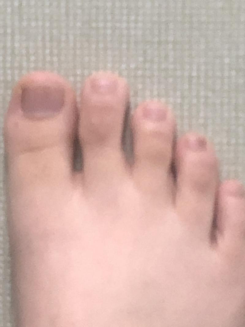 ㅇ