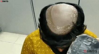 꿈에서 나는 갈색으로 머리를 염색했고 정수리 부분이 민머리였다. 탈모가 아니고 머리가 긴 상태에서 첨부한 사진처럼 정수리 부분만 동그랗게 밀었다