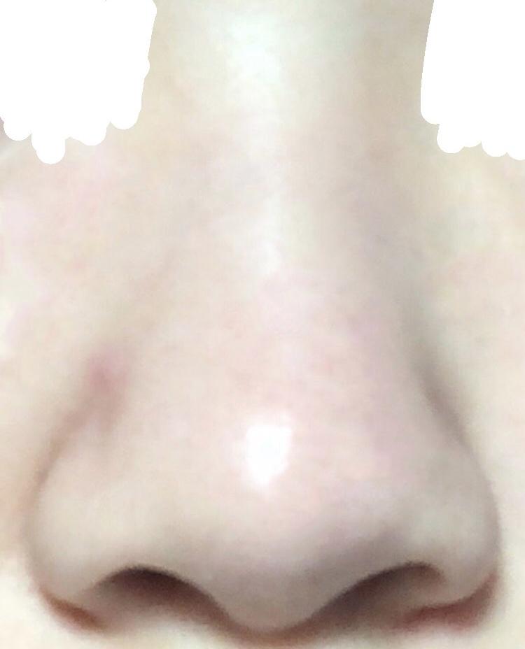 코 옆에 뾰루지는 무시해줘…^^