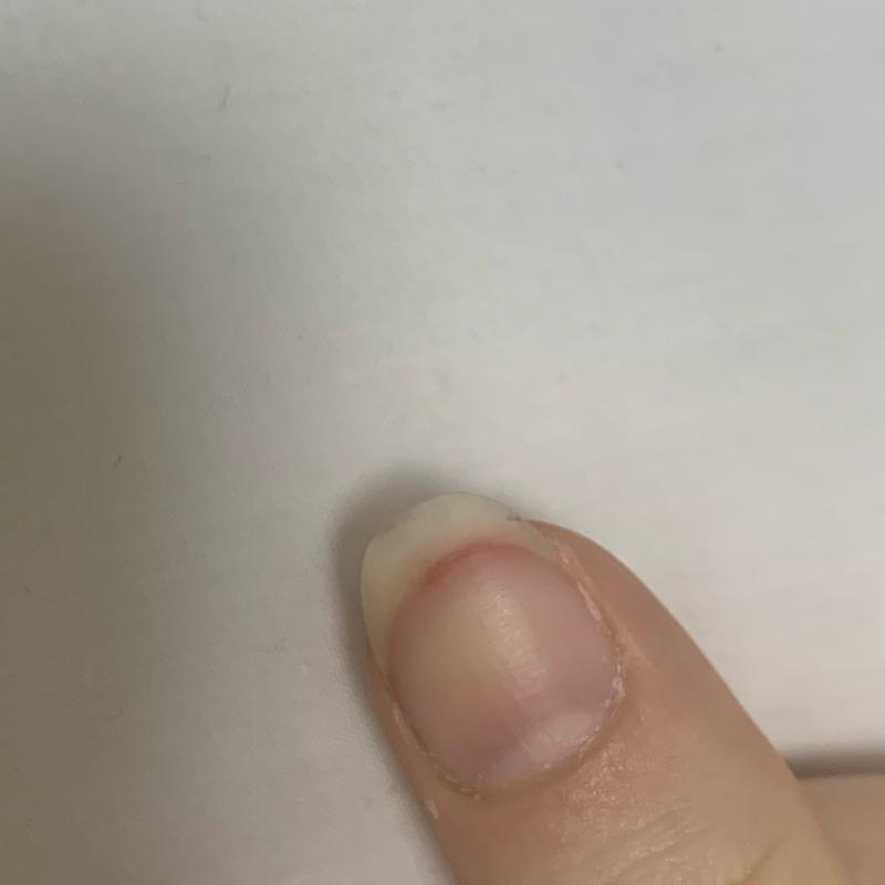 생각보다 좀 많이 깊숙하게 찌른 것 같더라고... 이젠 좀 괜찮아졌는데 생각지도 못한 순간에 피가 나오니까 굉장히 당황스러웠어...ㅎㅎ