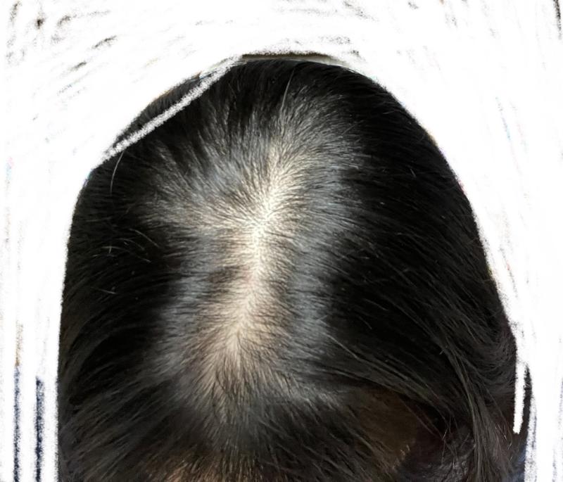 사진 첨부 사진애 따라 좀 다르게 보이긴 하지만....