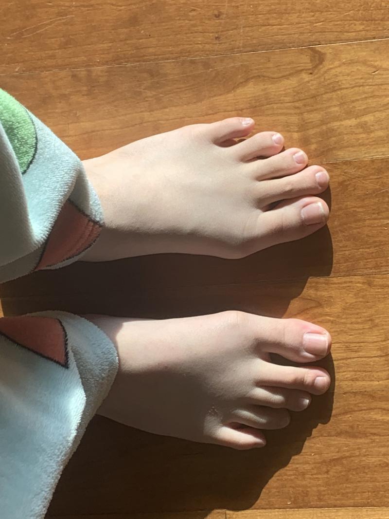 이거