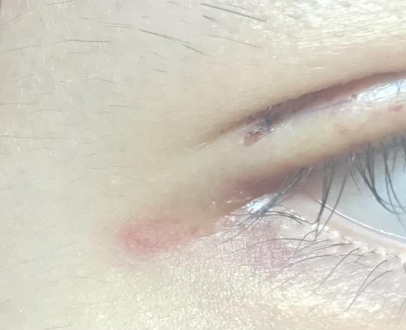 뭔가 긁힌 흉터 같이 생겼어... 사라ㅈㅣ겠지..?